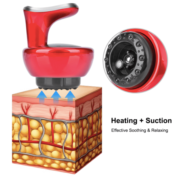 HexoMassage Electric Cupping & Scraping Machine