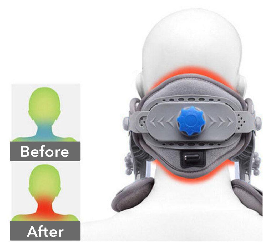 HexoNeck Advanced Heated Cervical Traction Device